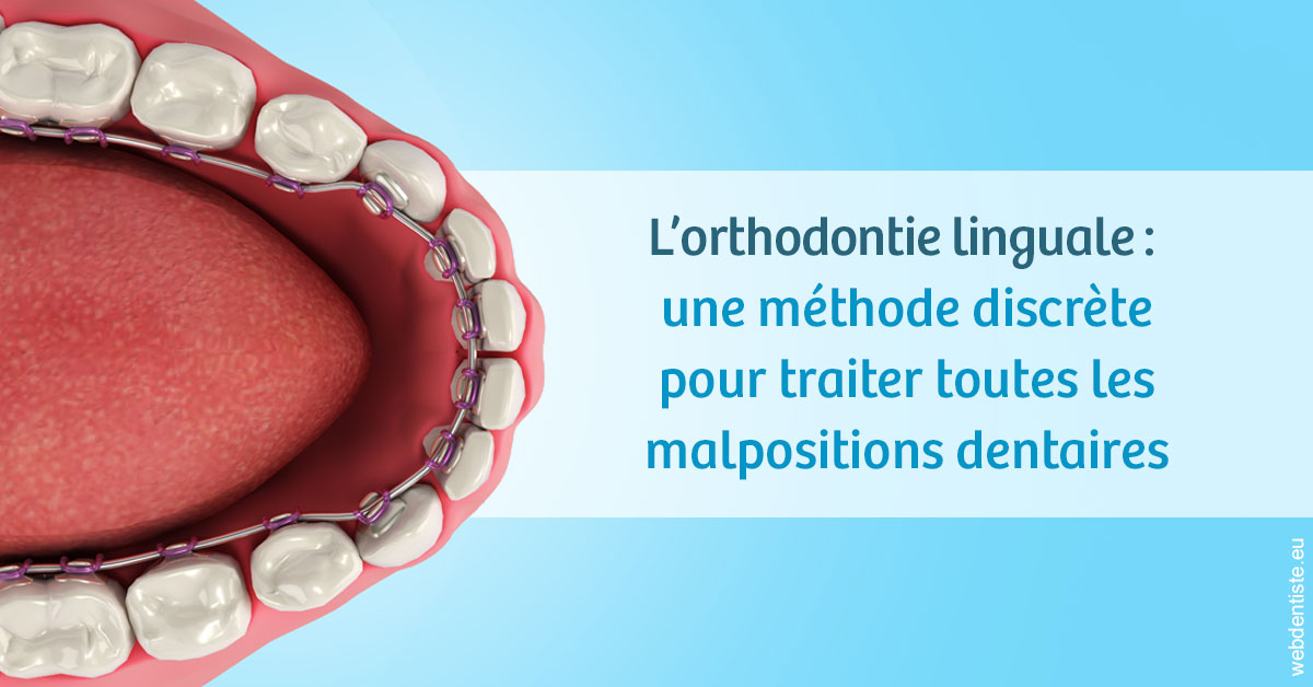 https://www.dr-christophe-carrere.fr/L'orthodontie linguale 1