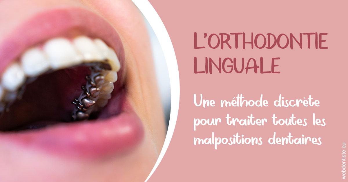 https://www.dr-christophe-carrere.fr/L'orthodontie linguale 2
