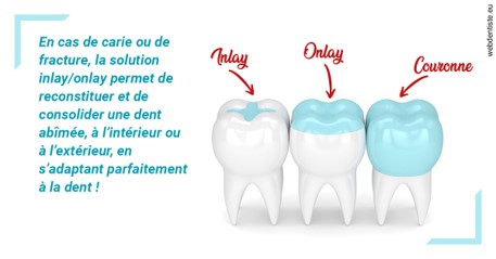https://www.dr-christophe-carrere.fr/L'INLAY ou l'ONLAY