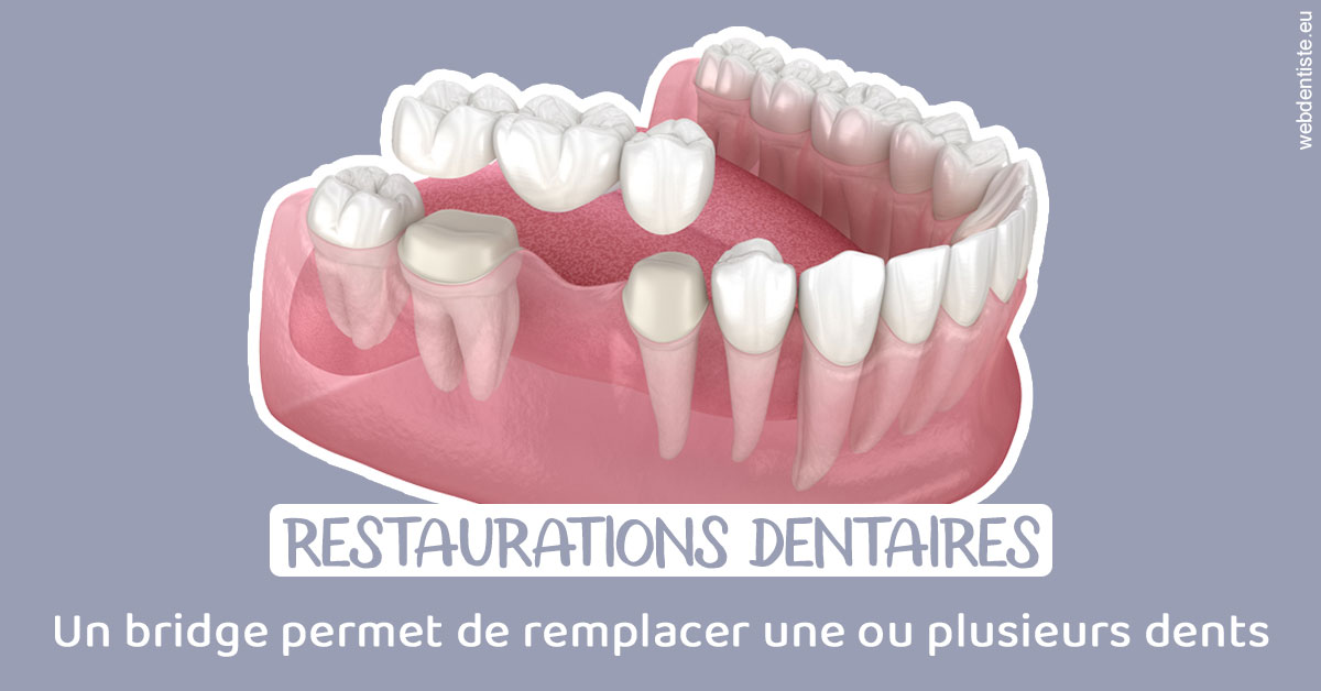 https://www.dr-christophe-carrere.fr/Bridge remplacer dents 1