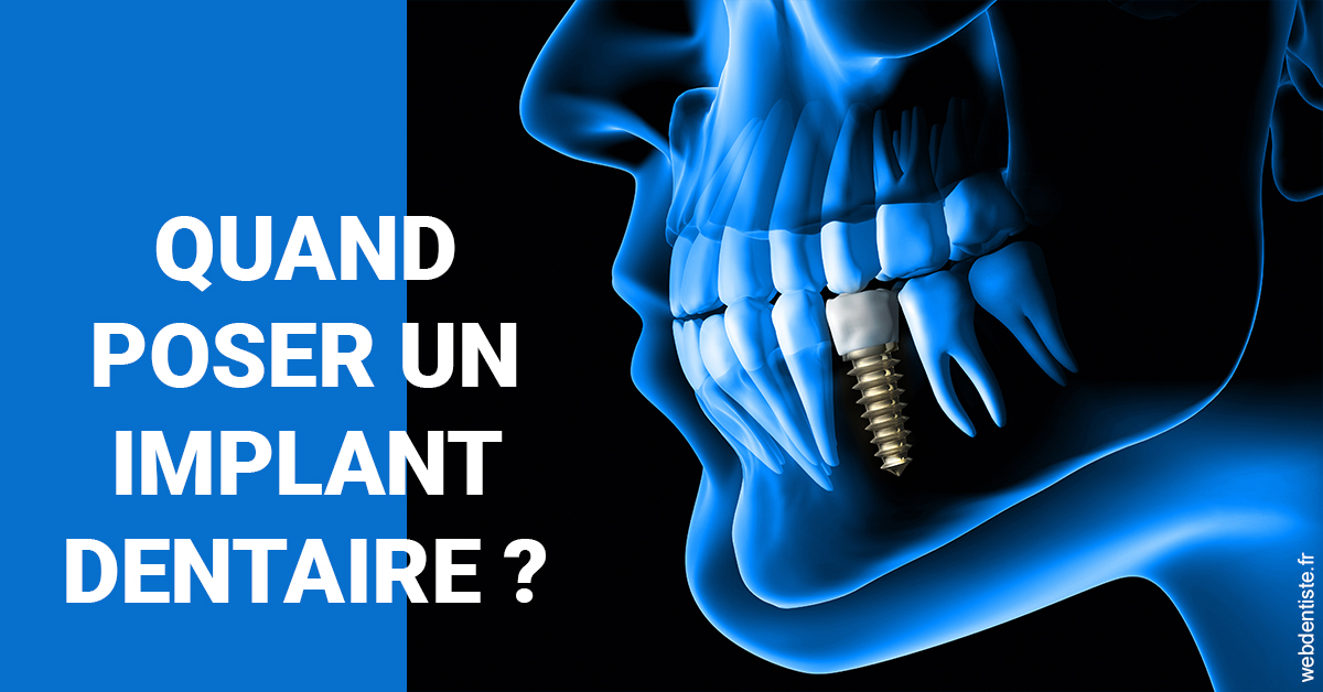 https://www.dr-christophe-carrere.fr/Les implants 1