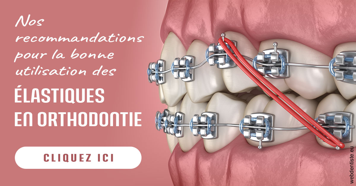 https://www.dr-christophe-carrere.fr/Elastiques orthodontie 2